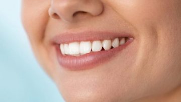 Prednosti ravnih zob in ortodontija