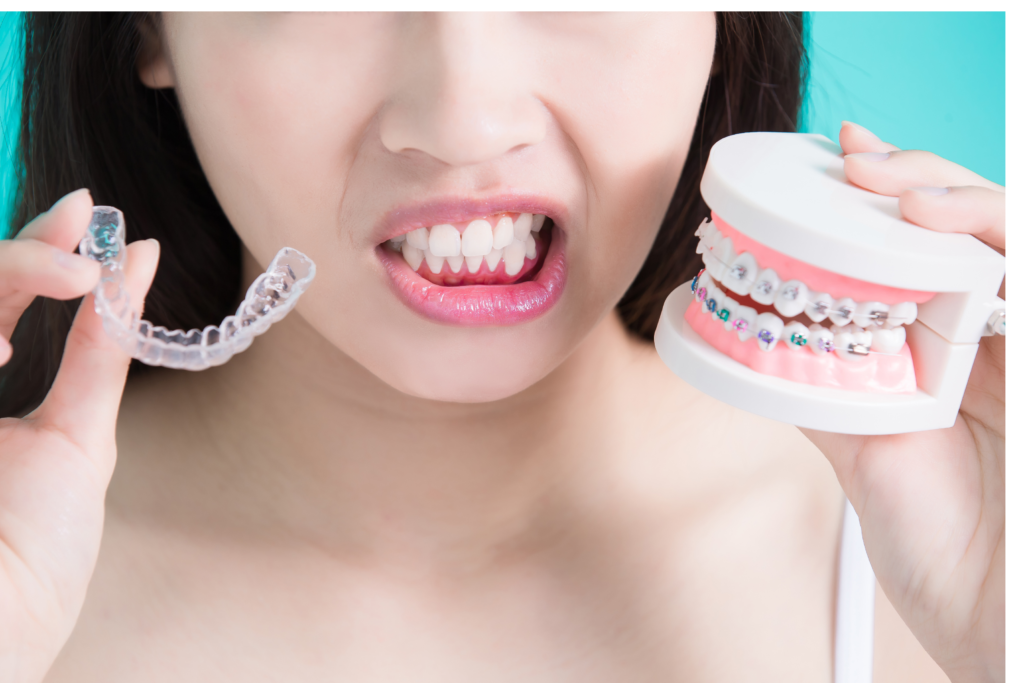 Zakaj izbrati nevidni zobni aparat - blog Ortodent